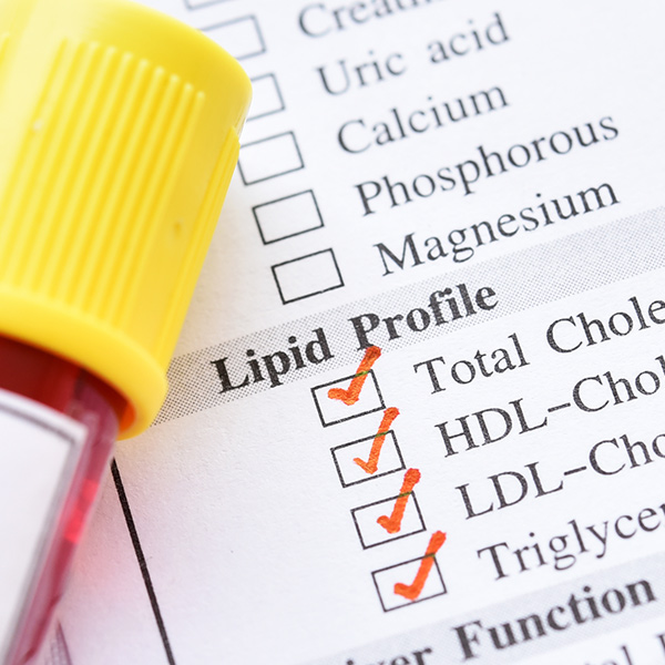 LDL cholesterol