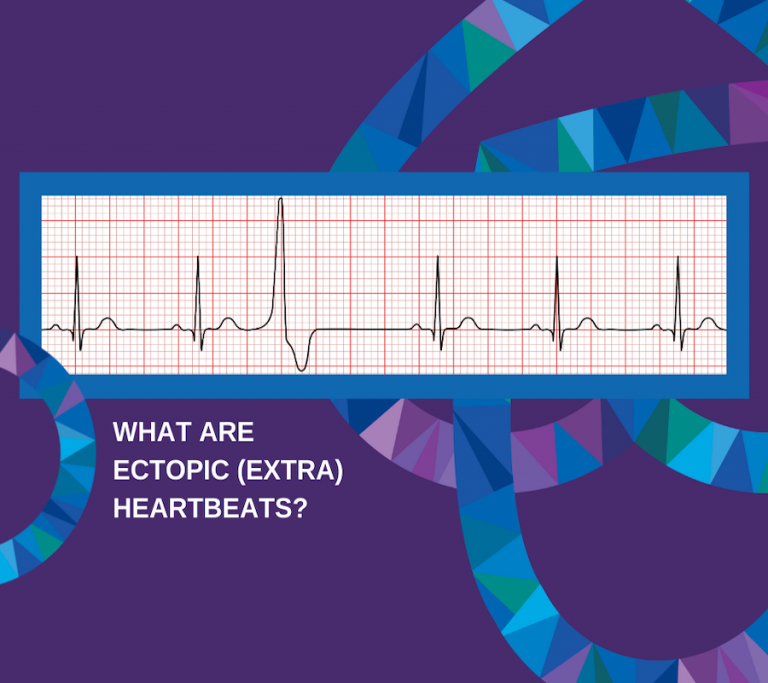 What Are Ectopic Heartbeats? - Connected Cardiology | Dr Jennifer Coller